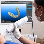 دندانپزشکی دیجیتال چیست؟ و همهچیز درباره آن