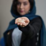 روکش ایمپلنت فوری در شهرک شهید محلاتی
